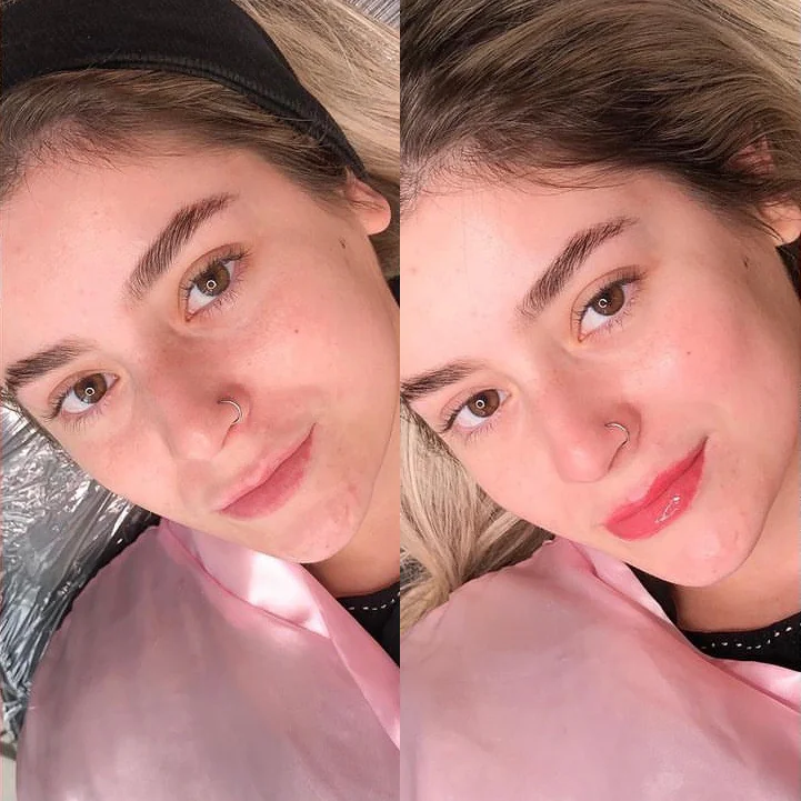 Comparativo de Baby Lips no rosto, mostrando a mudança de tonalidade dos lábios.