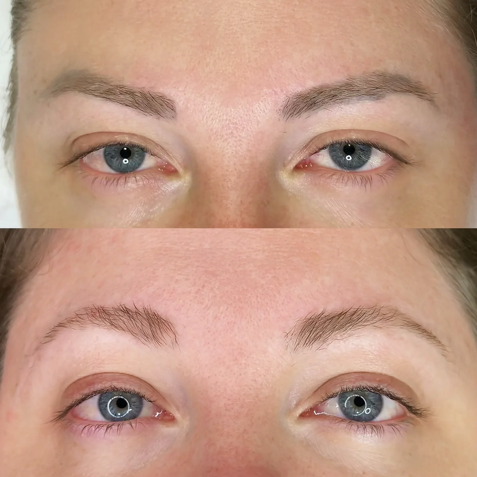 Comparativo do aspecto de pigmento antigo nas sobrancelhas durante remoção a laser.